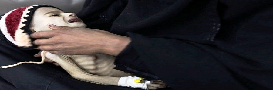 خطرات کمبود وزن بیشتر از چاقی است