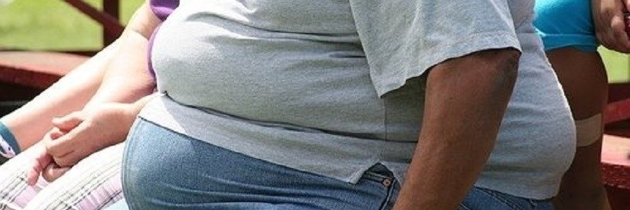 چربی کبدی تعیین کننده سلامت افراد چاق