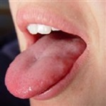 آیا چاقی حس چشایی را تغییر می دهد؟