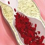 میزان و نوع چربی دریافتی و خطر بروز بیمار ی ها
