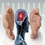 کمبود آهن و افزایش خطر سکته