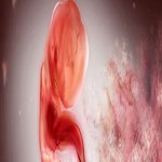 ابتلا به دیابت نوع 2 از همان دوران جنینی رقم می خورد!