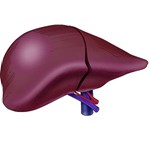 فعالیت ورزشی و بهبود بیماری کبد چرب غیر الکلی