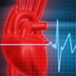 احتمال ابتلا به بیماری قلبی عروقی در مبتلایان به پسوریازیس زیاد است