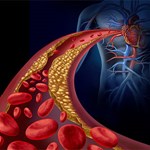 غذاهایی که به کاهش LDL-کلسترول کمک می کنند