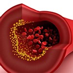 رژیم غذایی حاوی چربی های مفید میزان کلسترول خون را بهبود می دهد.