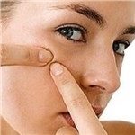 ارتباط برنامه غذایی با برزو آکنه