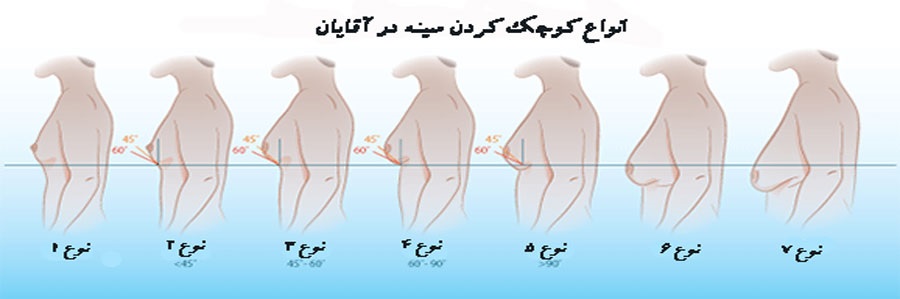 آقایان این جراحی زیبایی را انجام بدهند یا نه؟