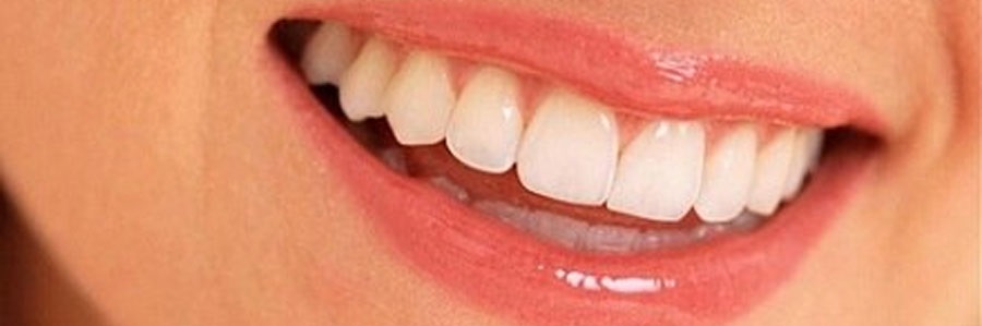 نوع لبخند و ارتودنسی : میزان نمایان شدگی دندانی و لثه ای