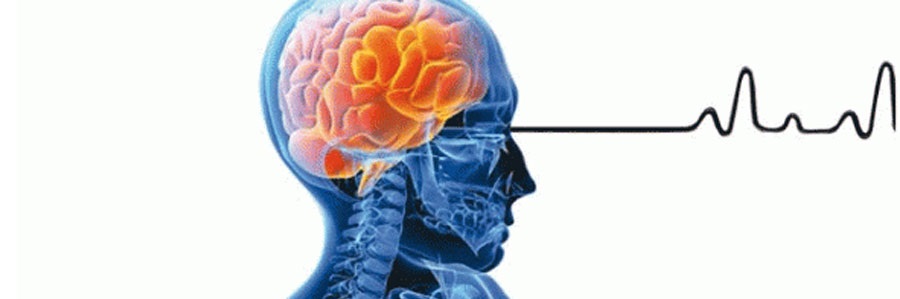 علائم و پیشگیری از سکته مغزی