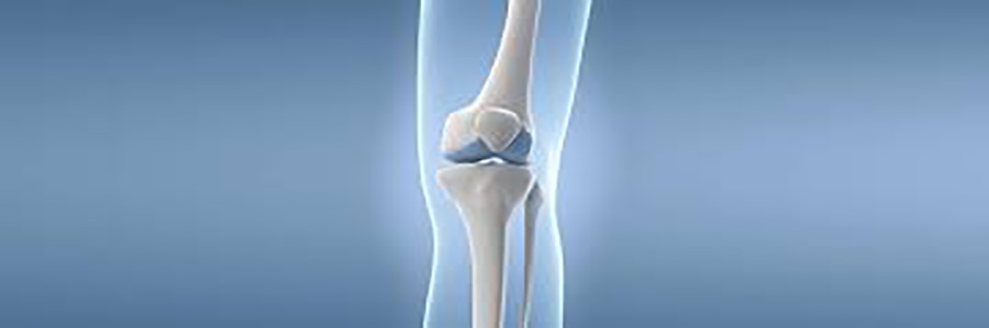 پوکی استخوان، مهمترین عارضه یائسگی