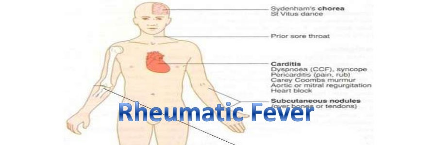 تب روماتیسمی