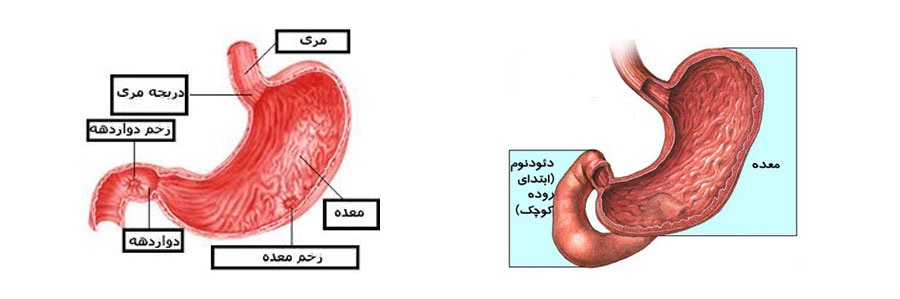 زخم های گوارشی