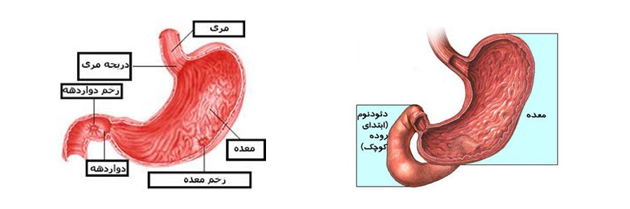زخم های گوارشی