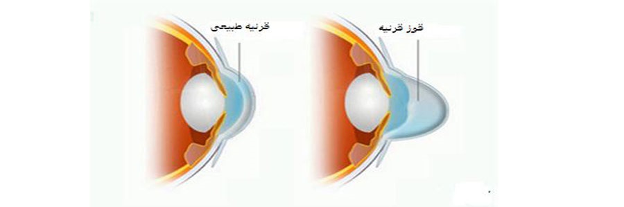 صلاح دید چشم