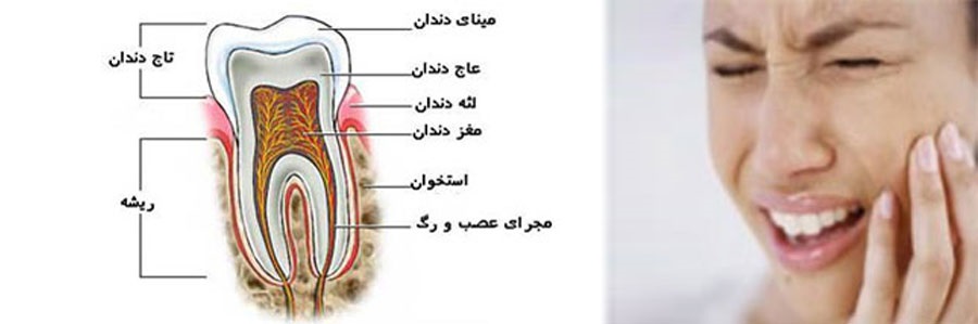 عصب کِشی یا عصب کُشی ؟!