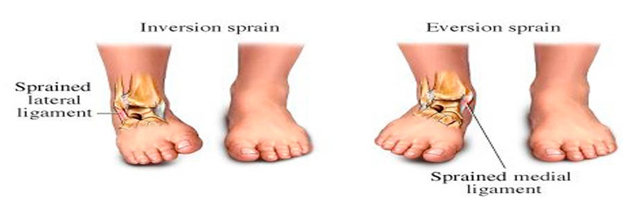 اندام تحتانی (پا)