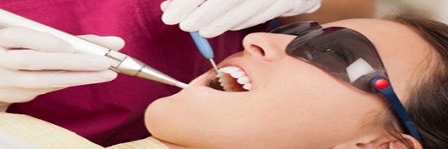 کاربردهای لیزر در دندانپزشکی