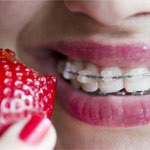 بهترین سن درمان انواع ناهنجاریهای دندانی و فکی
