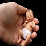 اهدای جنین -اهدای تخمک –تعیین جنسییت جنین با IVF & PGD