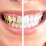 ایجاد خصوصیات ظاهری دندان به وسیله رنگ ها