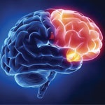 علائم و پیشگیری از سکته مغزی