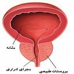 آنچه جوان تر ها بایستی در مورد ورم و التهاب پروستات بدانند