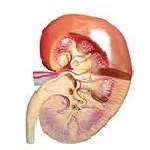 پیشگیری و درمان سنگ کلیه