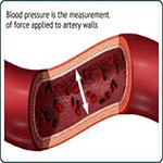 فشار خون چیست و علت فشار خون بالا؟