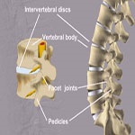 مداخلات کم تهاجمی ستون فقرات
