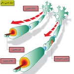 نحوه تشخیص بیماری ام اس