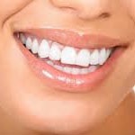 جراحی زیبایی لثه Esthetic Gum Surgery