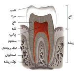 عصب کِشی یا عصب کُشی ؟!