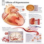 فشار خون بالا (هیپرتانسیون HYPERTENTION)