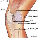 علت کم شدن آب داخل زانو چیست؟ چکار کنیم تا مایع درون مفصل زانو یا همان آب داخل زانو زیاد شود؟