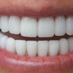 ۴۰ راز حفظ سلامتی دندان ها