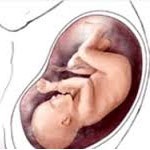 سقط در دو ماهگی