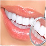 پایداری رنگ دندان ها با روش لامینت