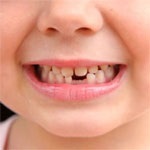 مراقبت از دندان‌های کودکان‌